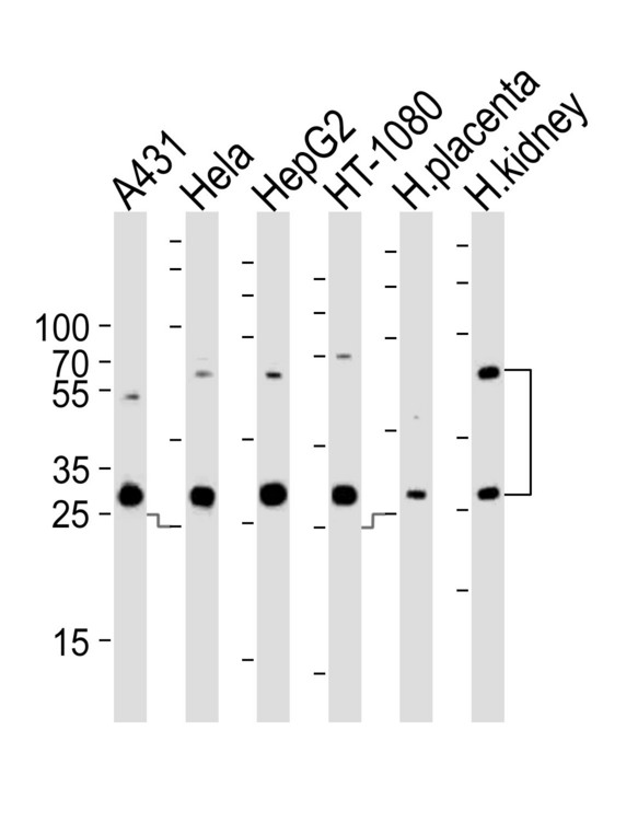 Western blot of lysates from A431, HeLa, HepG2, HT-1080 cell line and human placenta, kidney tissue lysate (from left to right), using CTSA Antibody. Antibody was diluted at 1:1000 at each lane. A goat anti-rabbit IgG H&L (HRP) at 1:10000 dilution was used as the secondary antibody. Lysates at 35ug per lane.