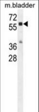 CTSA Antibody western blot of mouse bladder tissue lysates (35 ug/lane). The CTSA antibody detected the CTSA protein (arrow).