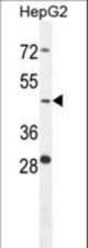 CTSA Antibody western blot of HepG2 cell line lysates (35 ug/lane). The CTSA antibody detected the CTSA protein (arrow).