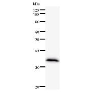 Western blot analysis of immunized recombinant protein, using anti-CIB2 monoclonal antibody.