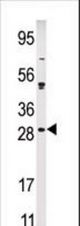 Western blot of anti-KIP2 antibody in Ramos cell line lysate (35 ug/lane). KIP2(arrow) was detected using the purified Pab