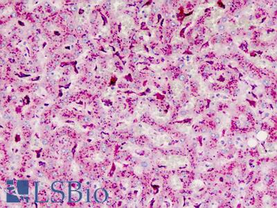 Human Liver: Formalin-Fixed, Paraffin-Embedded (FFPE)