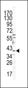 Western blot of CATB Antibody in Y79 cell line lysates (35 ug/lane). CATB (arrow) was detected using the purified antibody.