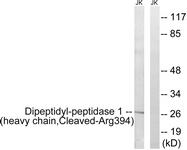 Western blot of extracts from Jurkat cells, treated with etoposide 25 uM 1h, using Dipeptidyl-peptidase 1 (heavy chain, Cleaved-Arg394) Antibody. The lane on the right is treated with the synthesized peptide.