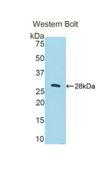 Western blot of recombinant CTSC / Cathepsin C / JP.