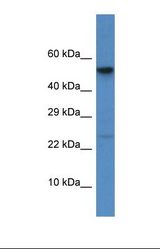 Western blot of Human HCT15. CTSC antibody dilution 1.0 ug/ml.