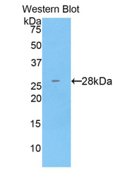 Western blot of recombinant CTSC / Cathepsin C / JP.