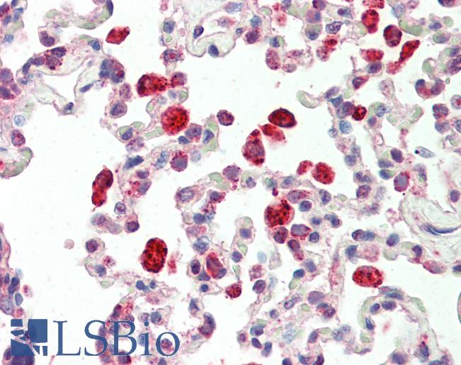 Anti-CTSC / Cathepsin C / JP antibody IHC staining of human lung. Immunohistochemistry of formalin-fixed, paraffin-embedded tissue after heat-induced antigen retrieval.