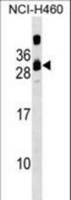 CIB3 Antibody western blot of NCI-H460 cell line lysates (35 ug/lane). The CIB3 antibody detected the CIB3 protein (arrow).