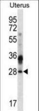 CIB4 Antibody western blot of human normal Uterus tissue lysates (35 ug/lane). The CIB4 antibody detected the CIB4 protein (arrow).