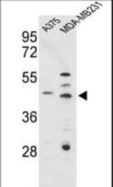 Western blot of CTSD Antibody in A375, MDA-MB231 cell line lysates (35 ug/lane). CTSD (arrow) was detected using the purified antibody.