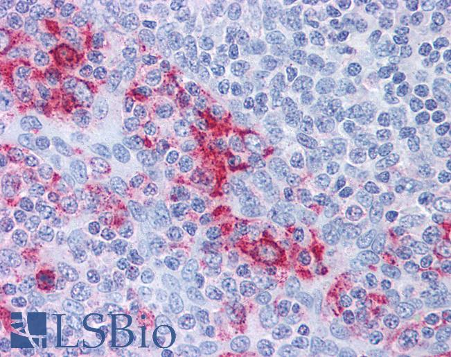 Anti-CTSE / Cathepsin E antibody IHC of human tonsil. Immunohistochemistry of formalin-fixed, paraffin-embedded tissue after heat-induced antigen retrieval. Antibody LS-B523 dilution 1:400.