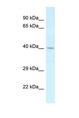 CTSE / Cathepsin E antibody LS-C145452 Western blot of Placenta lysate. Antibody concentration 1 ug/ml.