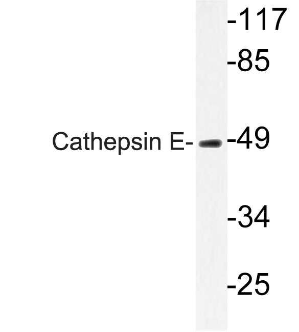 Western blot of Cathepsin E (I292) pAb in extracts from HUVEC cells.