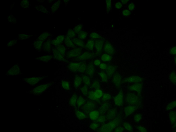 Immunofluorescence analysis of MCF-7 cell using CTSE antibody.