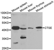 Western blot analysis of extracts of various tissues, using CTSE antibody.