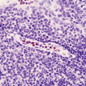 Formalin-fixed, paraffin-embedded human tonsil stained with peroxidase-conjugate and AEC chromogen. Note cytoplasmic staining of polymorphonuclear leukocytes.