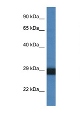 CTSG / Cathepsin G antibody LS-C145617 Western blot of 1 Cell lysate. Antibody concentration 1 ug/ml.