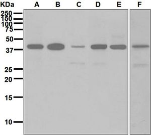 Western blot analysis on (A) A549, (B) SH-SY5Y, (C) LnCaP, (D) HepG2, (E) PC-12, and (F) K562 cell lysates using anti-Cathepsin H antibody.