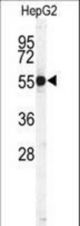 Western blot of CTSH Antibody in HepG2 cell line lysates (35 ug/lane). CTSH (arrow) was detected using the purified antibody.