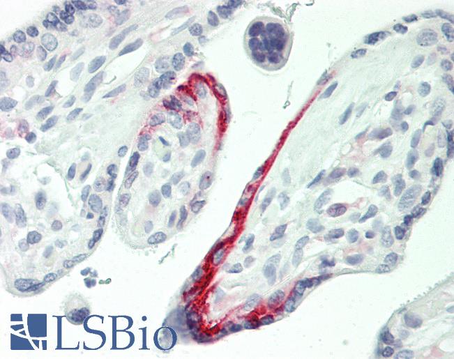 Human Placenta: Formalin-Fixed, Paraffin-Embedded (FFPE)