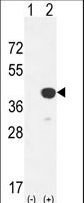 Western blot of CTSK (arrow) using rabbit polyclonal CTSK Antibody (Center R222). 293 cell lysates (2 ug/lane) either nontransfected (Lane 1) or transiently transfected with the CTSK gene (Lane 2).