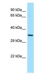 CTSL / Cathepsin L antibody Western Blot of HT1080.