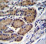 CTSO Antibody immunohistochemistry of formalin-fixed and paraffin-embedded human stomach tissue followed by peroxidase-conjugated secondary antibody and DAB staining.