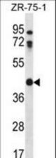 CTSO Antibody western blot of ZR-75-1 cell line lysates (35 ug/lane). The CTSO antibody detected the CTSO protein (arrow).