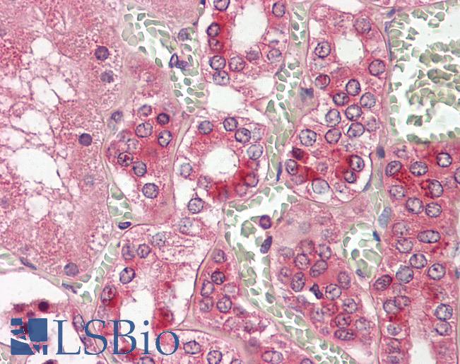 Anti-CTSV / Cathepsin V antibody IHC staining of human kidney. Immunohistochemistry of formalin-fixed, paraffin-embedded tissue after heat-induced antigen retrieval.
