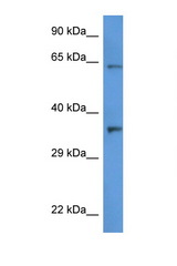CTSL2 / Cathepsin V antibody LS-C145331 Western blot of HT1080 Cell lysate. Antibody concentration 1 ug/ml.