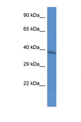 CTSL2 / Cathepsin V antibody LS-C145460 Western blot of HepG2 Cell lysate. Antibody concentration 1 ug/ml.