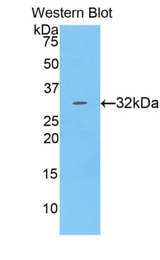 Western blot of recombinant CTSV / Cathepsin V.