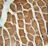 CTTB2 Antibody immunohistochemistry of formalin-fixed and paraffin-embedded human skeletal muscle followed by peroxidase-conjugated secondary antibody and DAB staining.