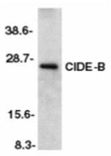 Western blot of CIDE-B in murine liver tissue lysate with CIDE-B antibody at 1:500 dilution.