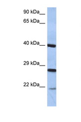 CIDEB antibody LS-C112310 Western blot of PANC1 Cell lysate. Antibody concentration 1 ug/ml.