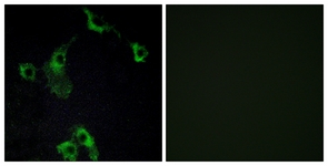Immunofluorescence of COS7 cells, using CIDEB Antibody. The picture on the right is treated with the synthesized peptide.