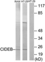 Western blot of extracts from HT-29/RAW264.7 cells, using CIDEB Antibody. The lane on the right is treated with the synthesized peptide.