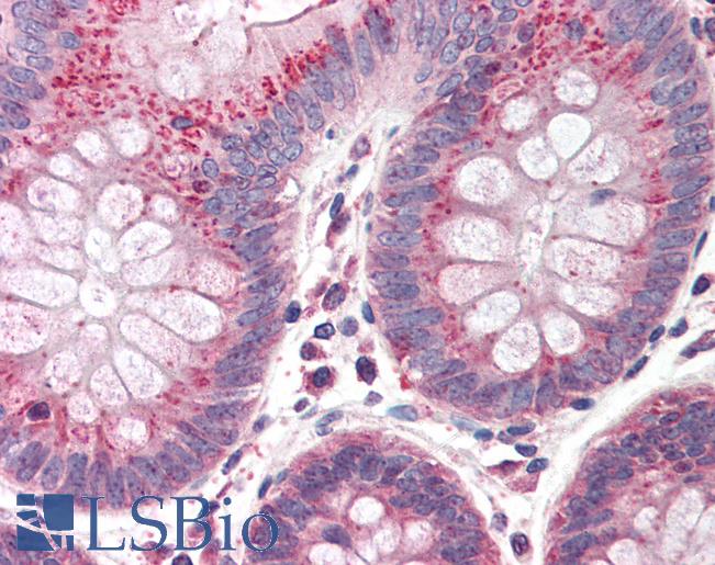 Anti-CUL9 / Cullin 9 antibody IHC of human colon. Immunohistochemistry of formalin-fixed, paraffin-embedded tissue after heat-induced antigen retrieval. Antibody LS-B401 dilution 1:500.