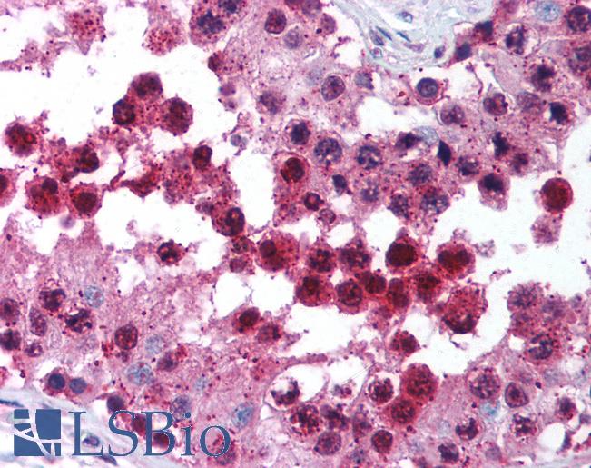 Anti-CUL9 / Cullin 9 antibody IHC of human testis. Immunohistochemistry of formalin-fixed, paraffin-embedded tissue after heat-induced antigen retrieval. Antibody LS-B1386 concentration 5 ug/ml.