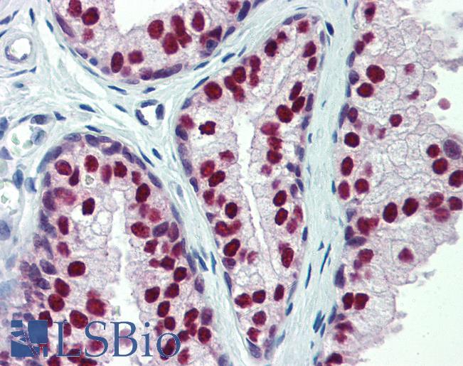 Anti-CUL9 / Cullin 9 antibody IHC of human prostate. Immunohistochemistry of formalin-fixed, paraffin-embedded tissue after heat-induced antigen retrieval. Antibody LS-B3911 concentration 10 ug/ml.