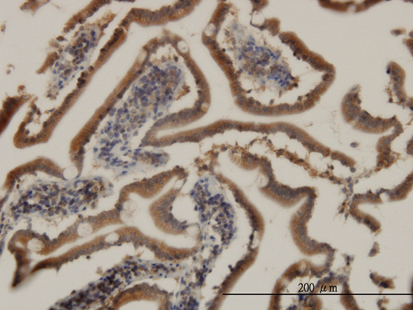 Immunoperoxidase of monoclonal antibody to CIDEB on formalin-fixed paraffin-embedded human small Intestine. [antibody concentration 3 ug/ml]