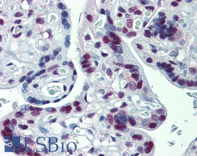 Anti-CUL9 / Cullin 9 antibody IHC of human placenta. Immunohistochemistry of formalin-fixed, paraffin-embedded tissue after heat-induced antigen retrieval. Antibody LS-B3911 concentration 10 ug/ml.