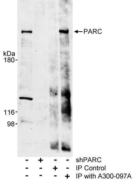 Detection of Human PARC by Western Blot and Immunoprecipitation. Samples. Whole cell lysate (40 ug for WB; 500 ug for IP) from untreated U2OS cells or U2OS derived cells that stably express a short hairpin RNA (shPARC) against PARC. Antibody: Affinity purified rabbit anti-PARC antibody used at 0.4 ug/ml for WB and at 2 ug/mg lysate for IP. Normal rabbit IgG was used as a control for immunoprecipitation (IP Control) Detection: Chemiluminescence with an exposure time of 5 minutes.