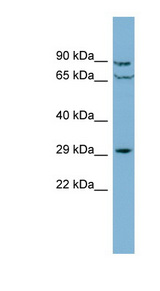 CUTC antibody LS-C107814 Western blot of Jurkat lysate.