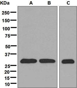 Western blot analysis on (A) Jurkat, (B) HeLa, and (C) A431 cell lysates using anti-CUTC antibody.