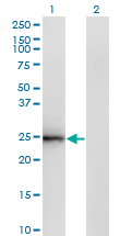 Western blot of CIDEB expression in transfected 293T cell line by CIDEB monoclonal antibody (M01), clone 2A10.