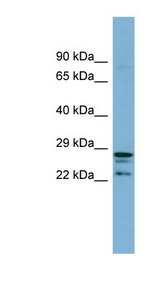 CUTC antibody LS-C107813 Western blot of 721_B cell lysate.