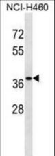 CUTC Antibody western blot of NCI-H460 cell line lysates (35 ug/lane). The CUTC antibody detected the CUTC protein (arrow).