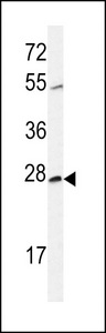 Western blot of CWC15 Antibody in CHO cell line lysates (35 ug/lane). CWC15 (arrow) was detected using the purified antibody.